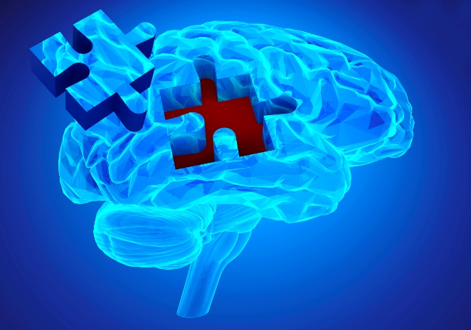 Alzheimer's
