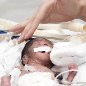 unplanned extubations