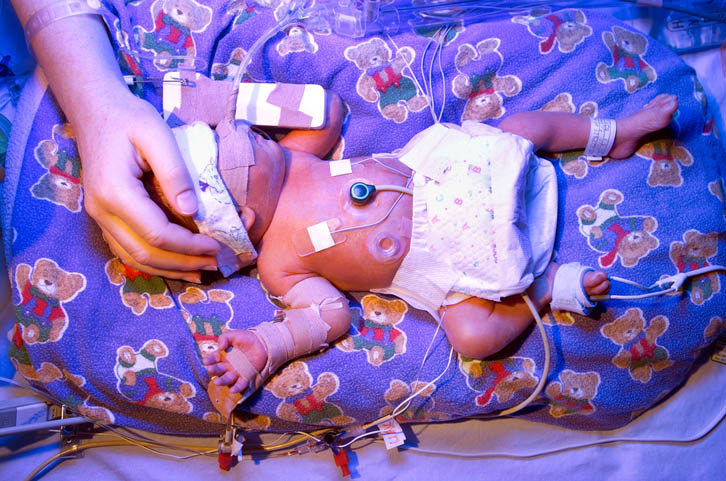 neonatal nurse