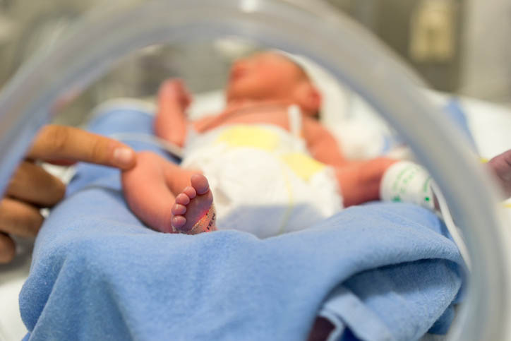 NNP with preemie