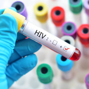 HIV test