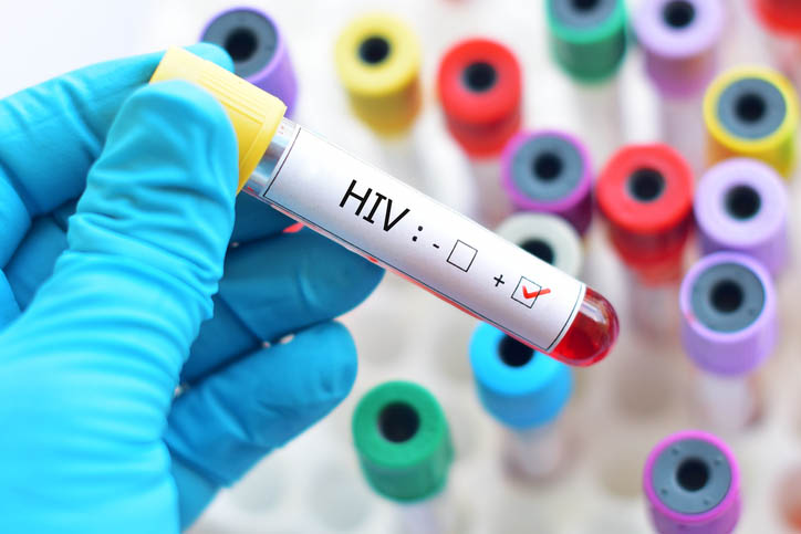 HIV test