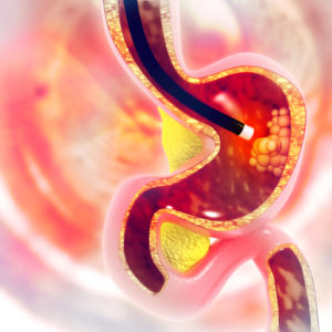 gastroenterology