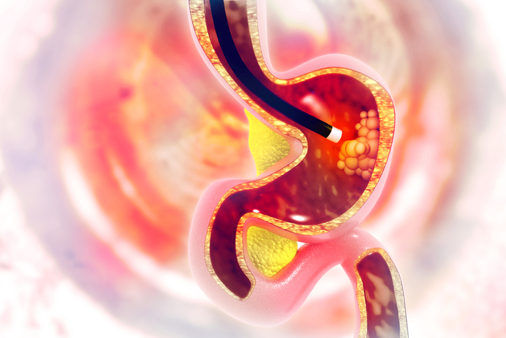 gastroenterology