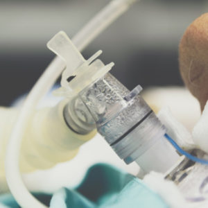 Communicating with a patient on a ventilator is difficult, but not impossible.