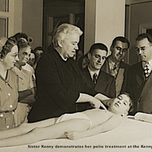 Sister Kenny demonstrates her polio treatment in Minneapolis, 1942.