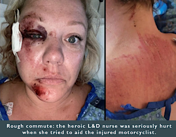 Amie Page, RN incurred serious injuries in attempting to rescue a cyclist.