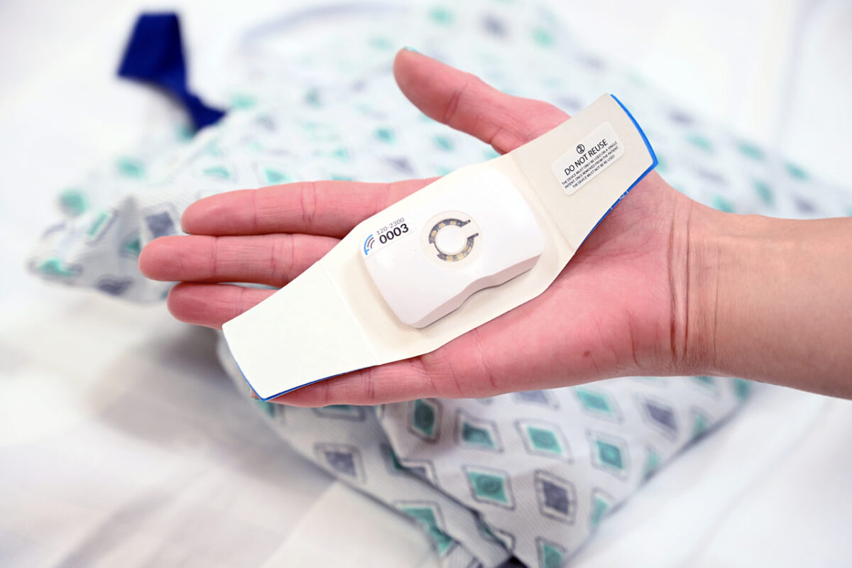 el-camino-health-is-first-to-use-new-blood-flow-monitoring-technology