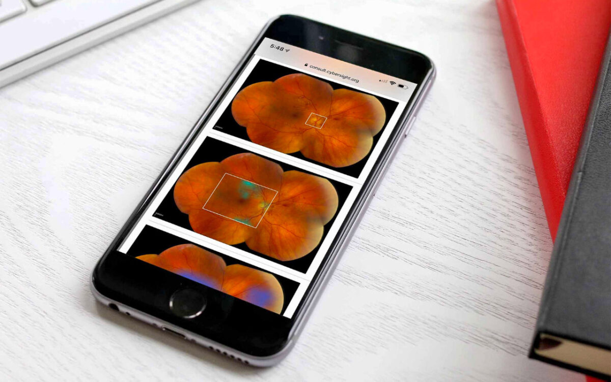 how-orbis-is-using-ai-in-their-award-winning-cybersight-program