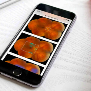 how-orbis-is-using-ai-in-their-award-winning-cybersight-program