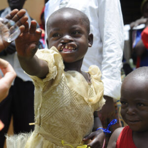 Operation Smile