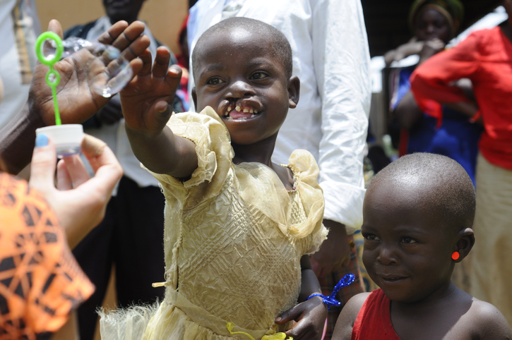 Operation Smile
