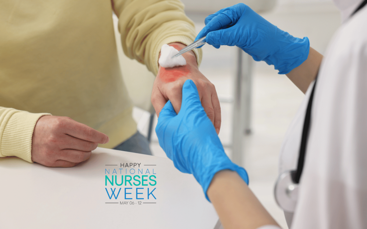 burn-care-for-underserved-communities-a-certified-burn-nurses-perspective